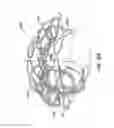 Fig. 46 - Everting heart valve