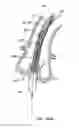 Fig. 55 - Everting heart valve