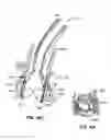 Fig. 62 - Everting heart valve