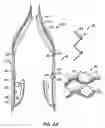 Fig. 05 - LOW PROFILE HEART VALVE AND DELIVERY SYSTEM
