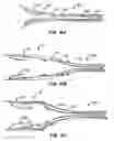 Fig. 06 - LOW PROFILE HEART VALVE AND DELIVERY SYSTEM