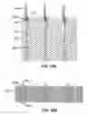 Fig. 29 - LOW PROFILE HEART VALVE AND DELIVERY SYSTEM