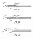 Fig. 32 - LOW PROFILE HEART VALVE AND DELIVERY SYSTEM