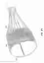 Fig. 35 - LOW PROFILE HEART VALVE AND DELIVERY SYSTEM
