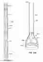 Fig. 40 - LOW PROFILE HEART VALVE AND DELIVERY SYSTEM