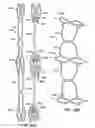 Fig. 44 - LOW PROFILE HEART VALVE AND DELIVERY SYSTEM