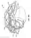 Fig. 46 - LOW PROFILE HEART VALVE AND DELIVERY SYSTEM