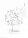 Fig. 03 - Replacement heart valve with diaphragm