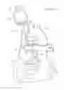 Fig. 08 - Sizing methods for a valved conduit graft