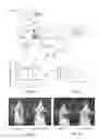 Fig. 11 - Delivery of Therapy to Living Tissue