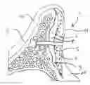 Fig. 01 - Device for covering and/or reconstructing a bone defect site, method for producing a cap for a cover for a bone defect site