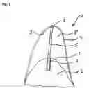 Fig. 02 - Device for covering and/or reconstructing a bone defect site, method for producing a cap for a cover for a bone defect site