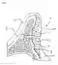 Fig. 04 - Device for covering and/or reconstructing a bone defect site, method for producing a cap for a cover for a bone defect site