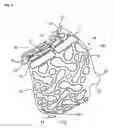 Fig. 07 - Device for covering and/or reconstructing a bone defect site, method for producing a cap for a cover for a bone defect site