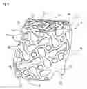 Fig. 09 - Device for covering and/or reconstructing a bone defect site, method for producing a cap for a cover for a bone defect site