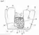 Fig. 10 - Device for covering and/or reconstructing a bone defect site, method for producing a cap for a cover for a bone defect site