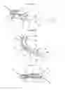 Fig. 10 - Intersomatic cage, intervertebral prosthesis, anchoring device and implantation instruments