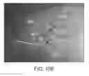 Fig. 14 - Implant placement