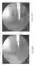 Fig. 32 - Implant placement