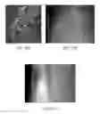 Fig. 37 - Implant placement
