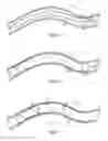 Fig. 04 - Deploying a balloon expandable stent to induce spiral flow