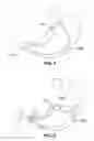 Fig. 07 - GASTRO-ESOPHAGEAL IMPLANTS