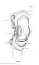 Fig. 06 - Knee Distractor Apparatus and Method