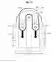 Fig. 20 - Force transmitting frame and motion assistance apparatus including the same