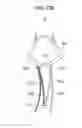 Fig. 23 - Force transmitting frame and motion assistance apparatus including the same