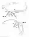 Fig. 15 - Eyewear system for securing lens on a user's nose and dilating user's nose