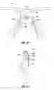 Fig. 16 - Eyewear system for securing lens on a user's nose and dilating user's nose
