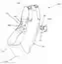 Fig. 01 - Arm immobilization apparatus and methods for wearing the apparatus