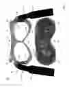 Fig. 06 - THERMAL EYE COMPRESS SYSTEMS AND METHODS OF USE