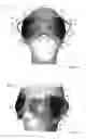 Fig. 08 - THERMAL EYE COMPRESS SYSTEMS AND METHODS OF USE