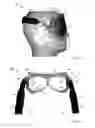 Fig. 09 - THERMAL EYE COMPRESS SYSTEMS AND METHODS OF USE