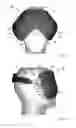 Fig. 17 - THERMAL EYE COMPRESS SYSTEMS AND METHODS OF USE