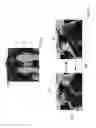 Fig. 23 - THERMAL EYE COMPRESS SYSTEMS AND METHODS OF USE