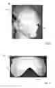 Fig. 27 - THERMAL EYE COMPRESS SYSTEMS AND METHODS OF USE