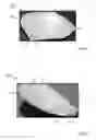 Fig. 29 - THERMAL EYE COMPRESS SYSTEMS AND METHODS OF USE