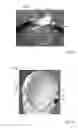 Fig. 30 - THERMAL EYE COMPRESS SYSTEMS AND METHODS OF USE