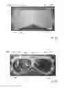 Fig. 44 - THERMAL EYE COMPRESS SYSTEMS AND METHODS OF USE