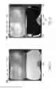 Fig. 50 - THERMAL EYE COMPRESS SYSTEMS AND METHODS OF USE