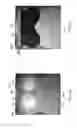 Fig. 52 - THERMAL EYE COMPRESS SYSTEMS AND METHODS OF USE
