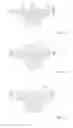 Fig. 56 - THERMAL EYE COMPRESS SYSTEMS AND METHODS OF USE