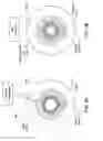 Fig. 05 - SYSTEM FOR NONPHARMACOLOGIC LONG-TERM CONSTRICTION OF A PUPIL