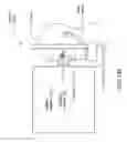 Fig. 27 - SYSTEM FOR NONPHARMACOLOGIC LONG-TERM CONSTRICTION OF A PUPIL