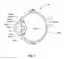 Fig. 02 - DIGITALLY CONTROLLED OPTICAL SYSTEM FOR NONPHARMACOLOGIC CONSTRICTION OF A PUPIL