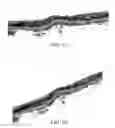 Fig. 03 - Optical coherence tomography cross view imaging