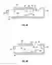 Fig. 06 - FORMED CUTTER FOR VITRECTOMY PROBE