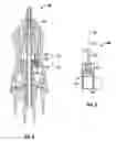 Fig. 08 - FORMED CUTTER FOR VITRECTOMY PROBE
